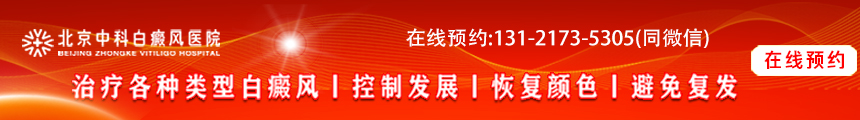 北京白癜風醫院